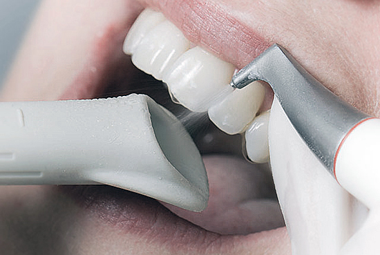 AIRFLOW - Revolutionary dental technology now at d-spa